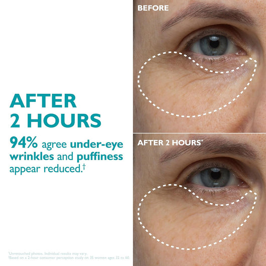 Peptide patches for wrinkles and Under eye bags