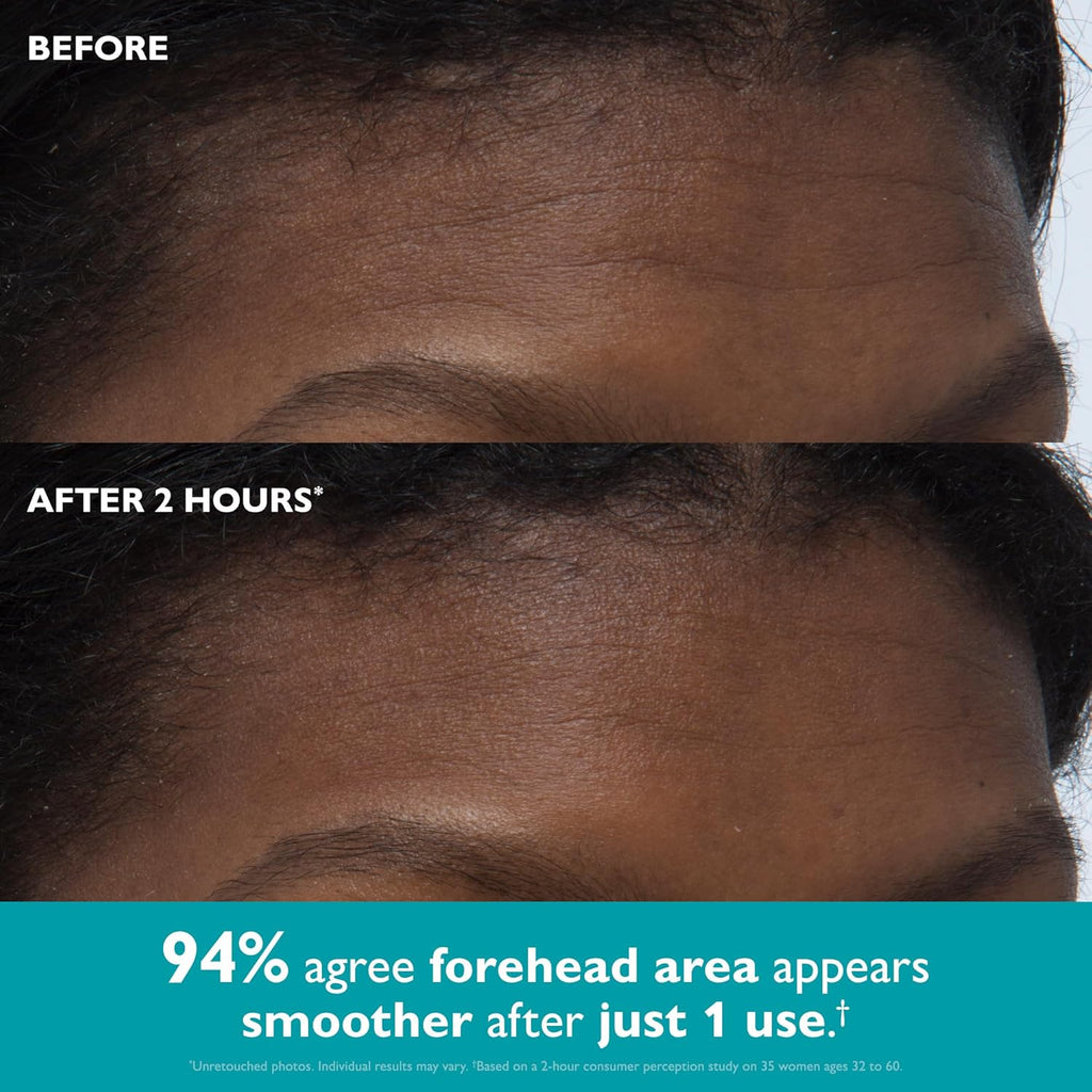 Peptide patches for wrinkles and Under eye bags